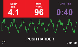 ZOLL AED 3 Defibrillator - Cardiac X  Automated External Defibrillator