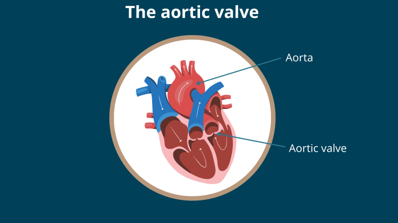 What does the Aortic Valve do in the heart?