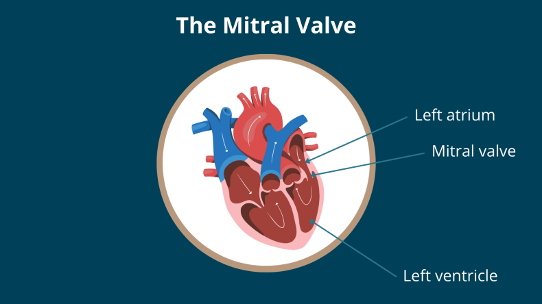 What does the Mitral Valve do in the heart?