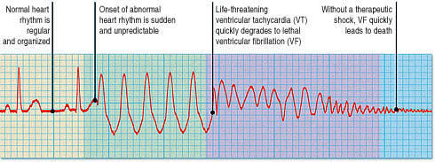 Can you use an AED and shock a person in a non-shockable rhythm?