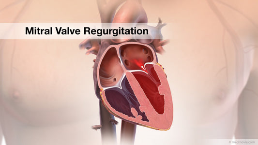 What is more significant Severe Aortic Stenosis (AS) or Severe Mitral Regurgitation (MR)?