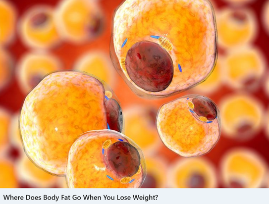 What happens to fat when you lose weight? An expert reports.