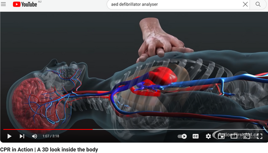 CPR in action, a 3D look inside the body.