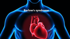 What is Barlows Syndrome?