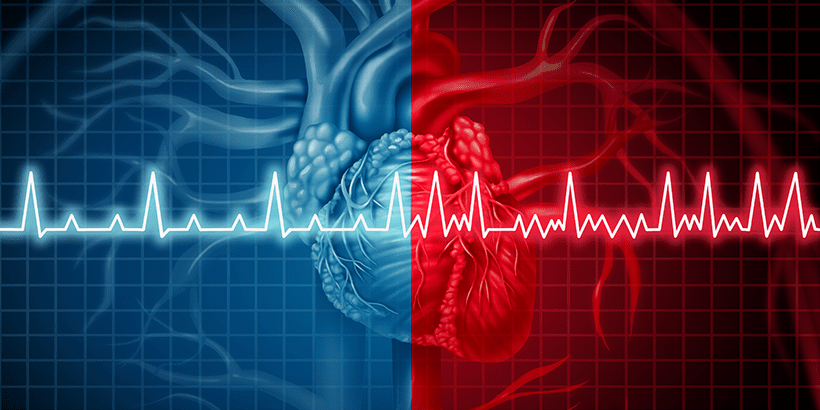 What is Cardiac Tamponade?