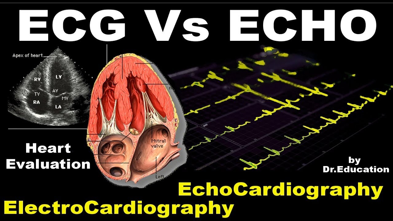 What is the difference between an ECG and an Echo? | Cardiac X