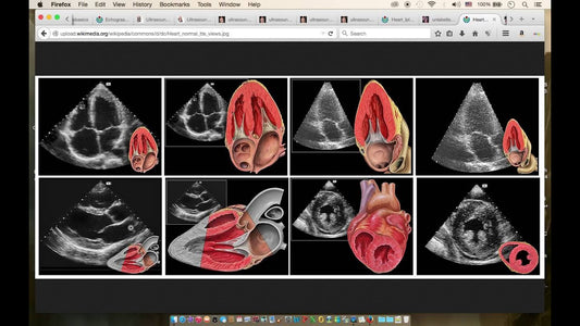 Why should ICU intensivists obtain basic 'point of care' Echocardiography training?